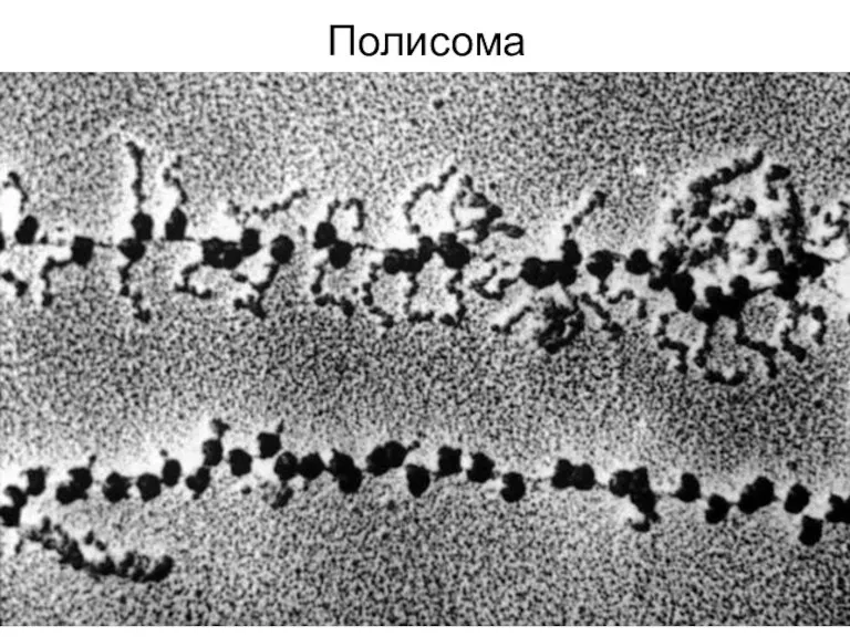 Полисома