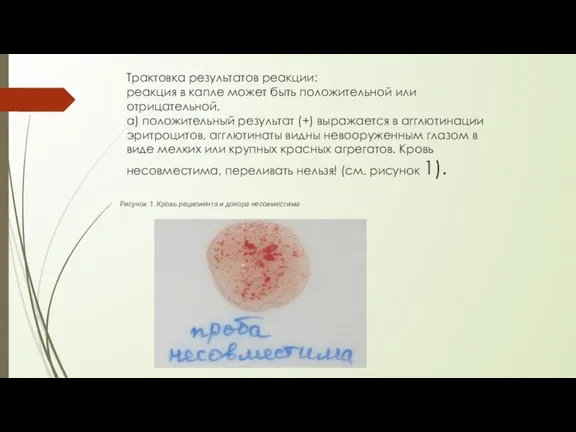 Трактовка результатов реакции: реакция в капле может быть положительной или отрицательной. а)