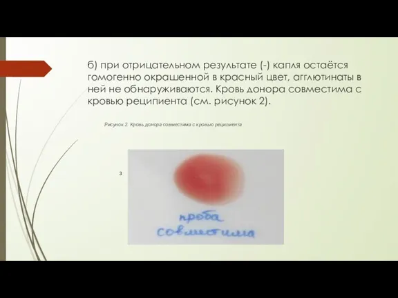 б) при отрицательном результате (-) капля остаётся гомогенно окрашенной в красный цвет,