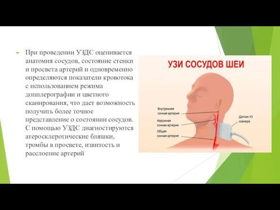 При проведении УЗДС оценивается анатомия сосудов, состояние стенки и просвета артерий и