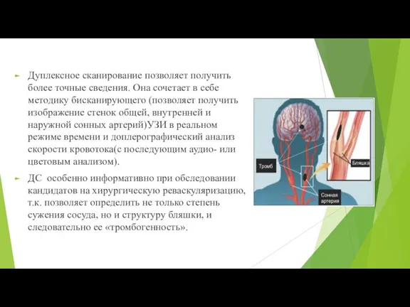 Дуплексное сканирование позволяет получить более точные сведения. Она сочетает в себе методику