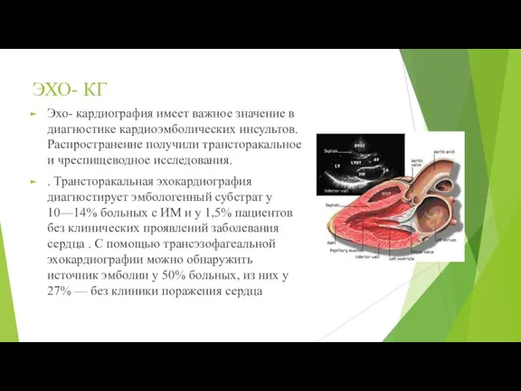 ЭХО- КГ Эхо- кардиография имеет важное значение в диагностике кардиоэмболических инсультов. Распространение