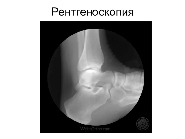 Рентгеноскопия