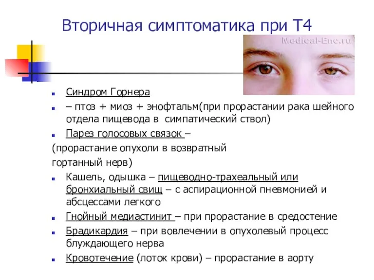 Вторичная симптоматика при Т4 Синдром Горнера – птоз + миоз + энофтальм(при