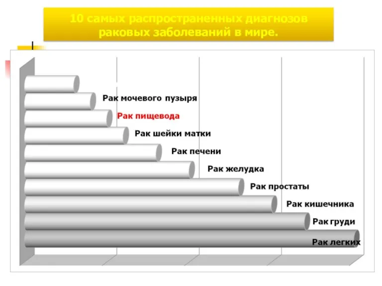 10 самых распространенных диагнозов раковых заболеваний в мире. Неходжкинская лимфома