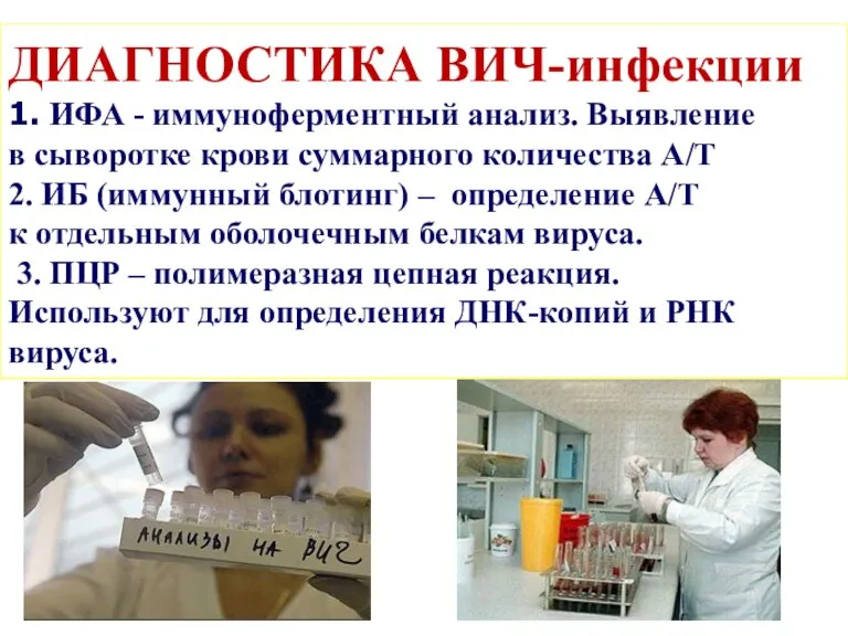 ДИАГНОСТИКА ВИЧ-инфекции 1. ИФА - иммуноферментный анализ. Выявление в сыворотке крови суммарного