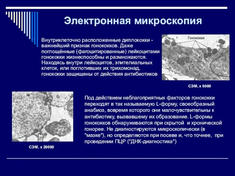 Электронная микроскопия Внутриклеточно расположенные диплококки - важнейший признак гонококков. Даже поглощённые (фагоцитированные)