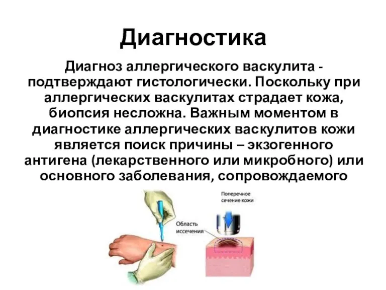 Диагностика Диагноз аллергического васкулита - подтверждают гистологически. Поскольку при аллергических васкулитах страдает