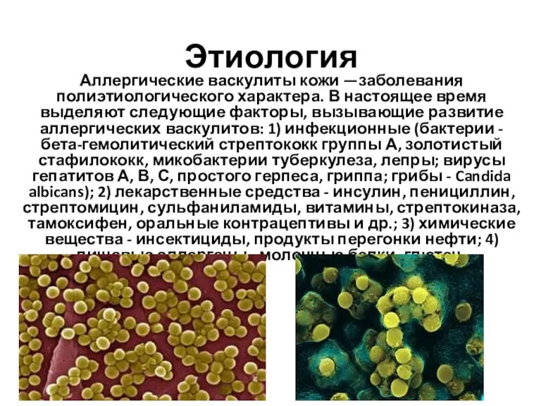 Этиология Аллергические васкулиты кожи —заболевания полиэтиологического характера. В настоящее время выделяют следующие