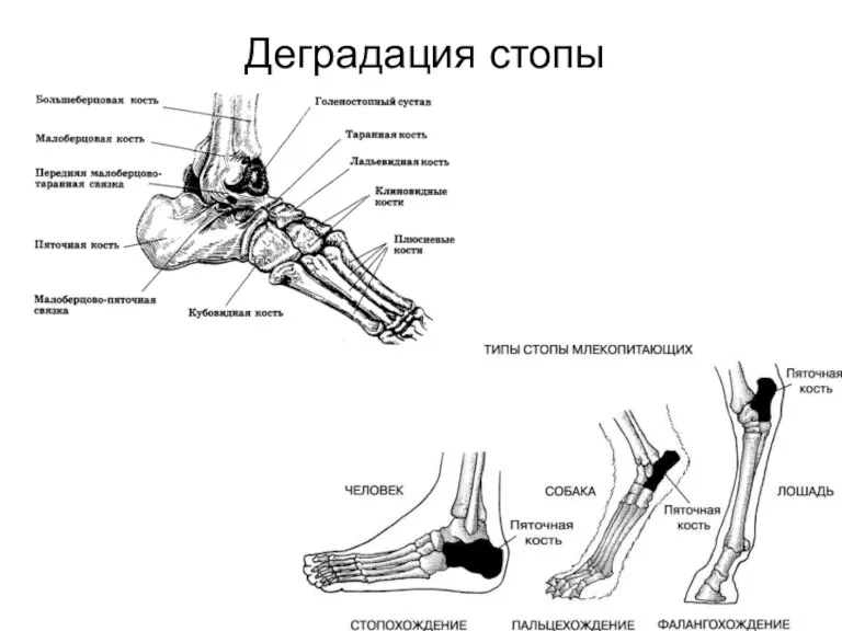 Деградация стопы