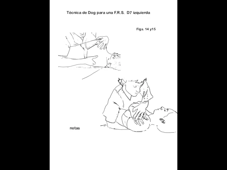 Figs. 14 y15 notas Técnica de Dog para una F.R.S. D7 izquierda