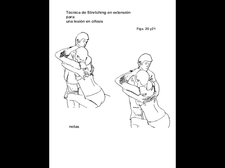Figs. 20 y21 notas Técnica de Stretching en extensión para una lesión en cifosis