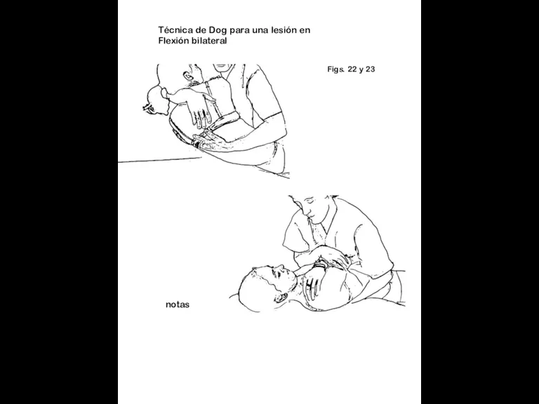 Figs. 22 y 23 notas Técnica de Dog para una lesión en Flexión bilateral