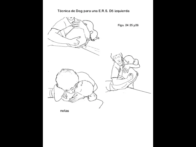 Figs. 24 25 y26 notas Técnica de Dog para una E.R.S. D5 izquierda