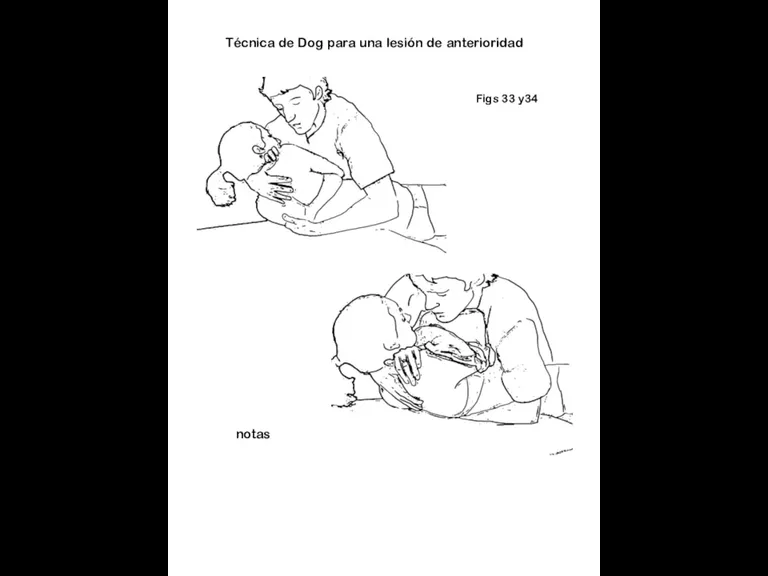 Figs 33 y34 notas Técnica de Dog para una lesión de anterioridad