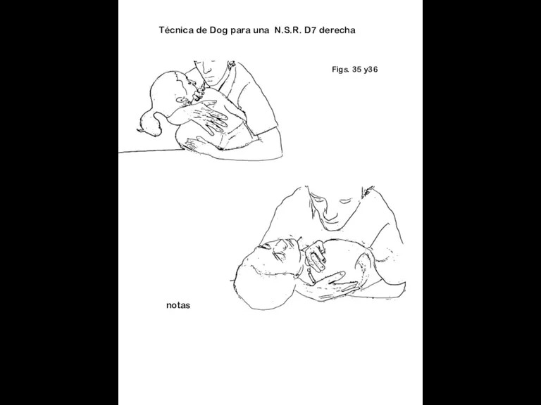 Figs. 35 y36 notas Técnica de Dog para una N.S.R. D7 derecha