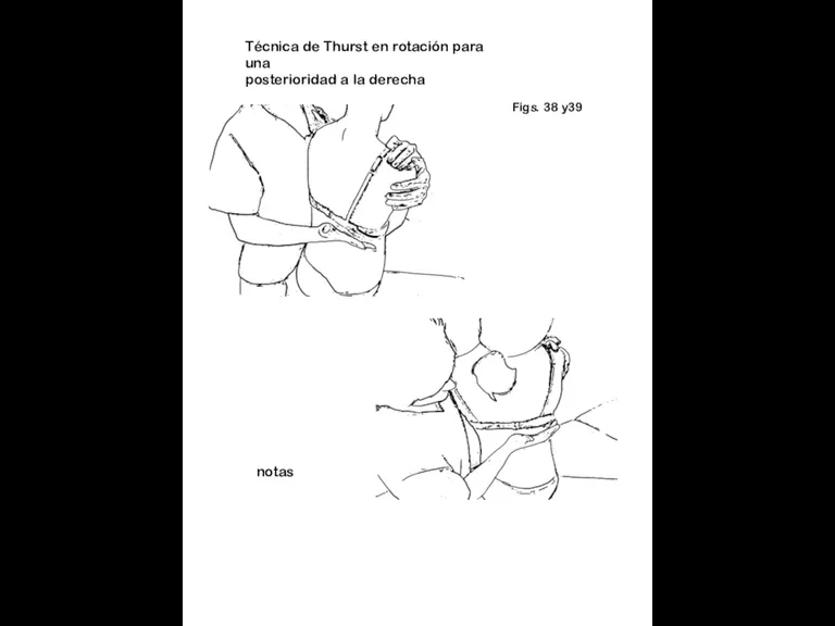 Figs. 38 y39 notas Técnica de Thurst en rotación para una posterioridad a la derecha
