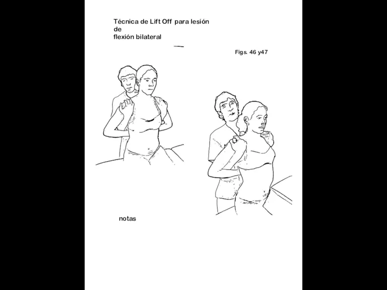 Figs. 46 y47 notas Técnica de Lift Off para lesión de flexión bilateral