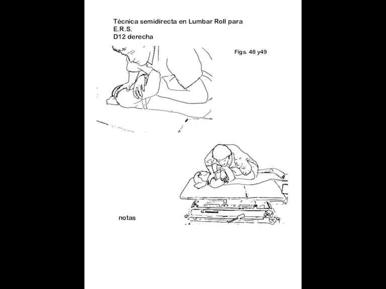 Figs. 48 y49 notas Técnica semidirecta en Lumbar Roll para E.R.S. D12 derecha