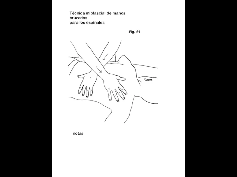 Fig. 51 notas Técnica miofascial de manos cruzadas para los espinales