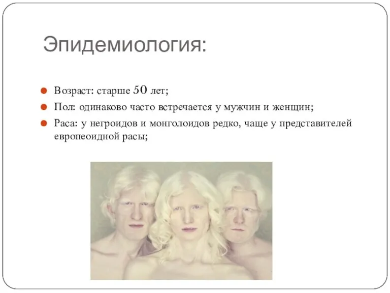 Эпидемиология: Возраст: старше 50 лет; Пол: одинаково часто встречается у мужчин и