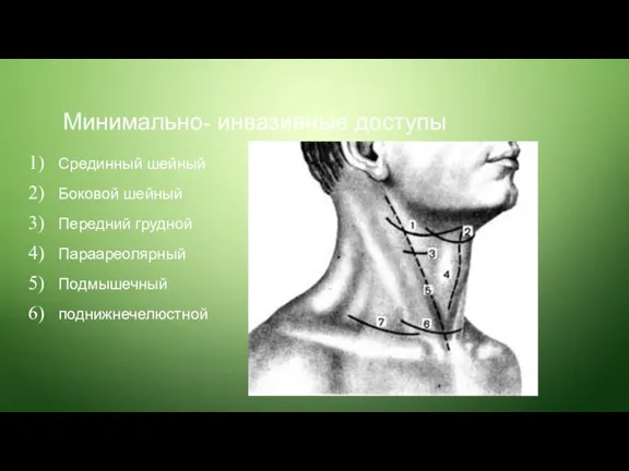 Минимально- инвазивные доступы Срединный шейный Боковой шейный Передний грудной Параареолярный Подмышечный поднижнечелюстной