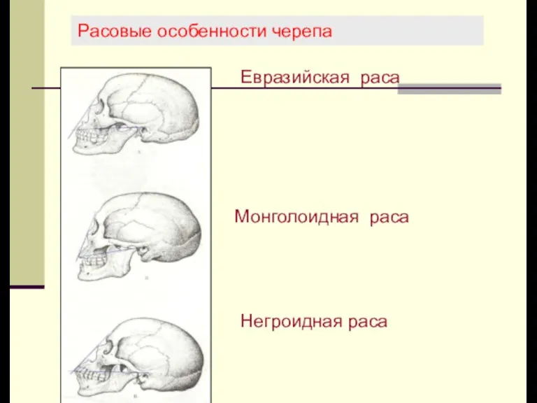 Расовые особенности черепа Евразийская раса Монголоидная раса Негроидная раса