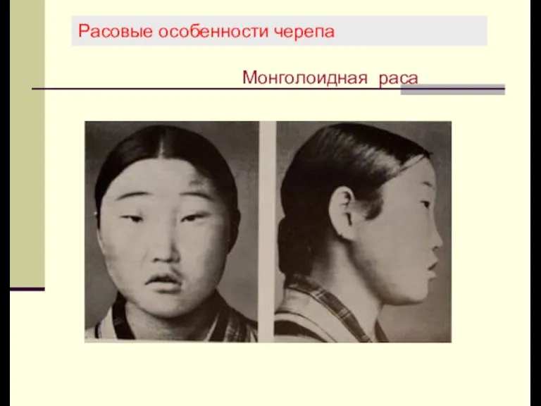 Расовые особенности черепа Монголоидная раса