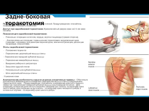 Задне-боковая торакотомия Положение пациента. На боку с рукой над головой. Предупреждение: опасайтесь