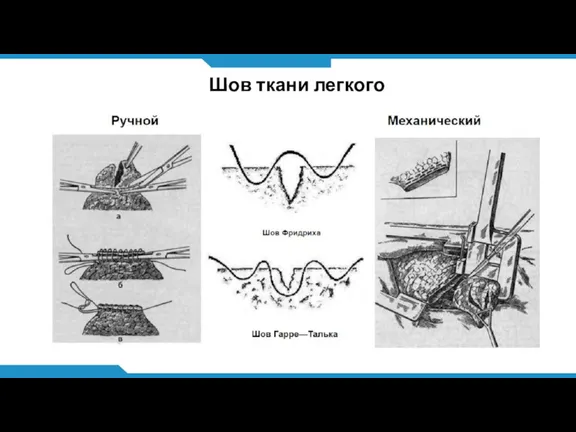 Шов ткани легкого