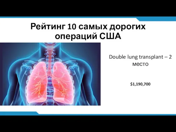 Рейтинг 10 самых дорогих операций США Double lung transplant – 2 место $1,190,700