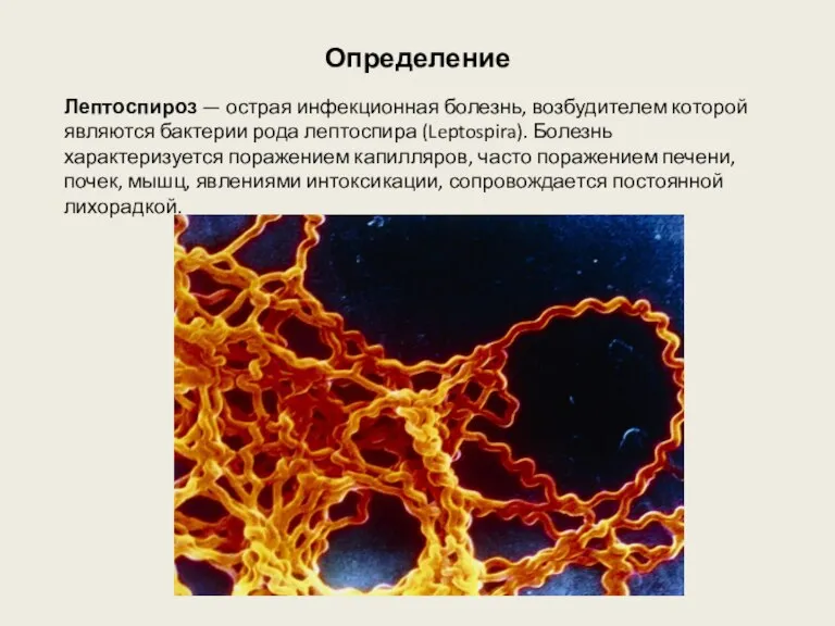 Определение Лептоспироз — острая инфекционная болезнь, возбудителем которой являются бактерии рода лептоспира