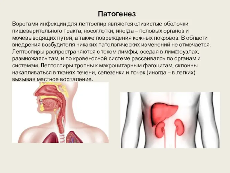 Патогенез Воротами инфекции для лептоспир являются слизистые оболочки пищеварительного тракта, носоглотки, иногда