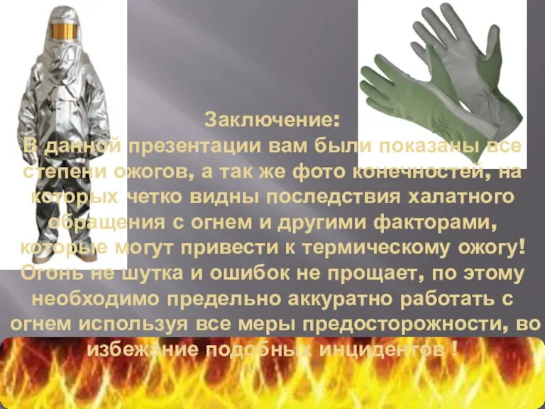 Заключение: В данной презентации вам были показаны все степени ожогов, а так