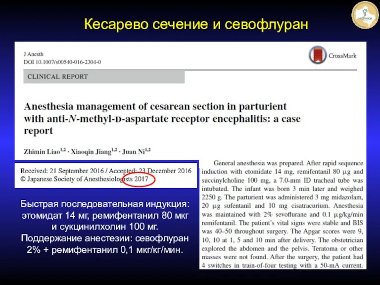 Кесарево сечение и севофлуран Быстрая последовательная индукция: этомидат 14 мг, ремифентанил 80