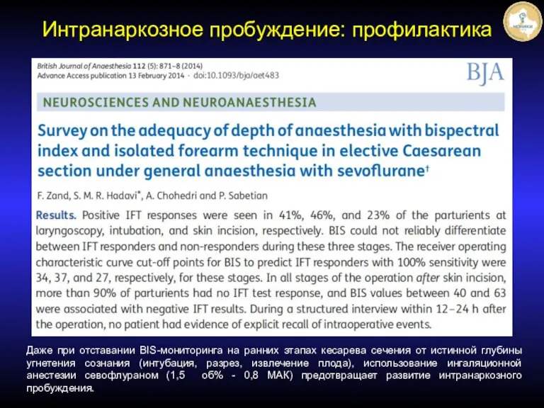 Даже при отставании BIS-мониторинга на ранних этапах кесарева сечения от истинной глубины