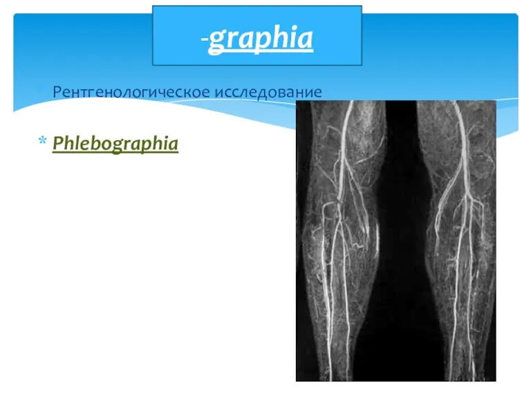 Рентгенологическое исследование Phlebographia -graphia