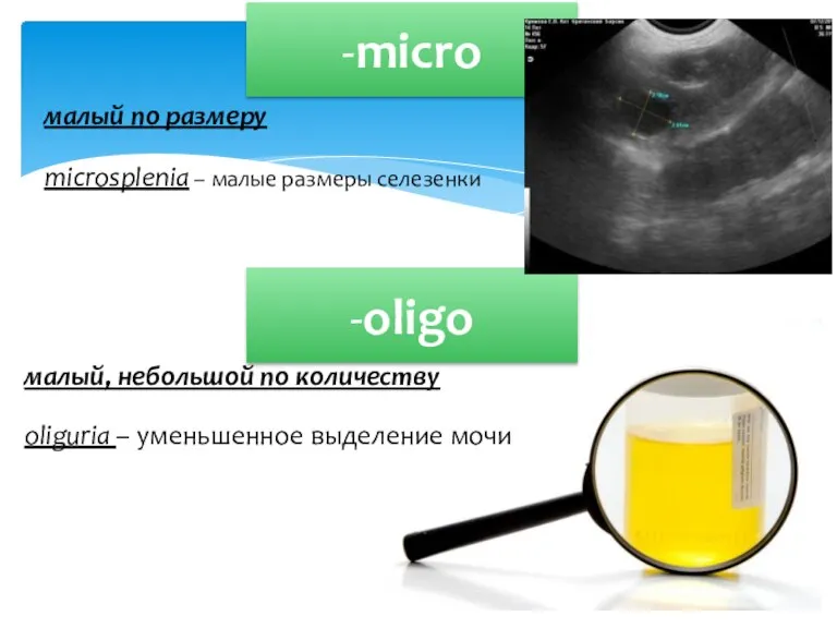 -micro -oligo малый по размеру microsplenia – малые размеры селезенки малый, небольшой