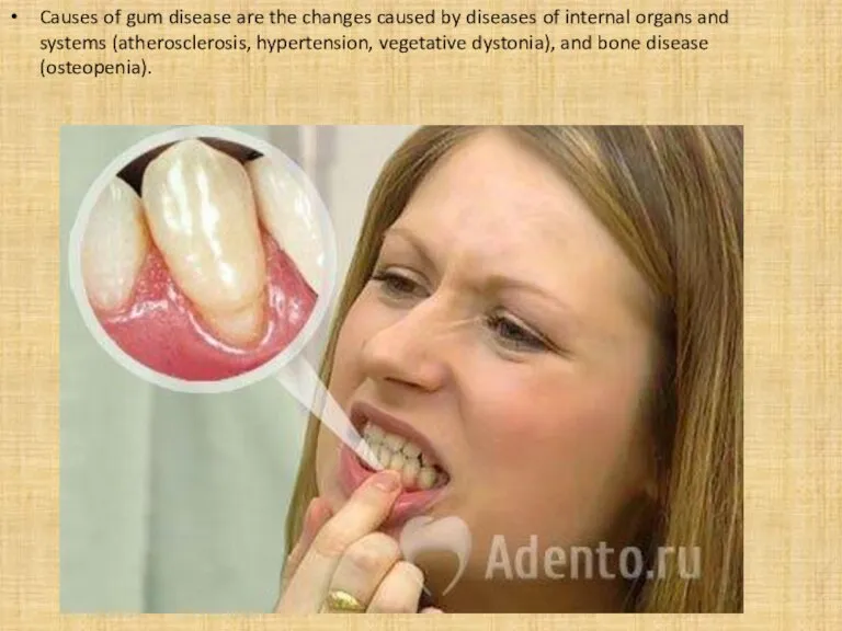 Causes of gum disease are the changes caused by diseases of internal