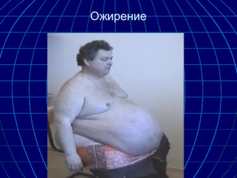 Ожирение