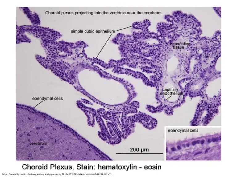 https://www.lfp.cuni.cz/histologie/Preparaty/preparaty2E.php?SYSTEM=Nervoustissue&PREPARAT=11