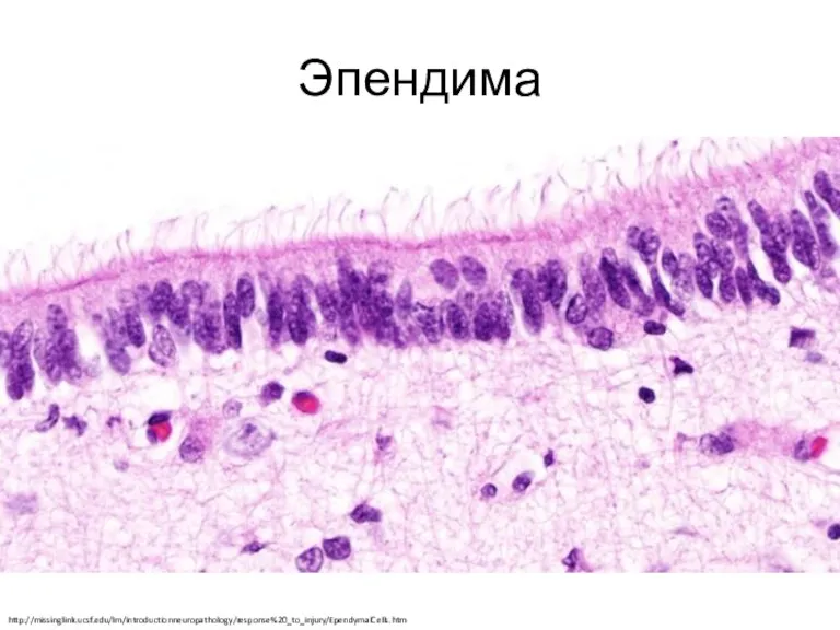 Эпендима http://missinglink.ucsf.edu/lm/introductionneuropathology/response%20_to_injury/EpendymalCells.htm