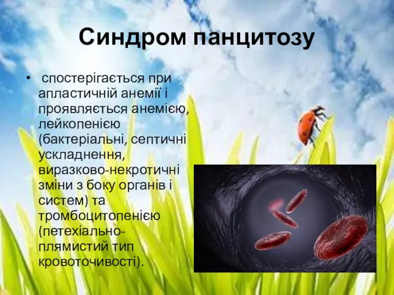 Синдром панцитозу спостерігається при апластичній анемії і проявляється анемією, лейкопенією (бактеріальні, септичні