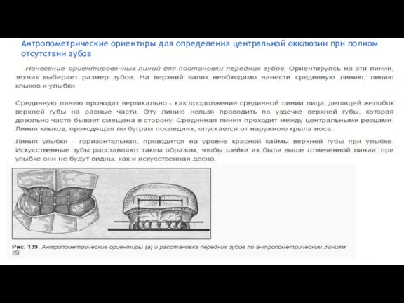 Антропометрические ориентиры для определения центральной окклюзии при полном отсутствии зубов