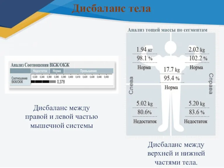 Дисбаланс тела Дисбаланс между верхней и нижней частями тела. Дисбаланс между правой