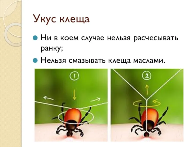 Укус клеща Ни в коем случае нельзя расчесывать ранку; Нельзя смазывать клеща маслами.