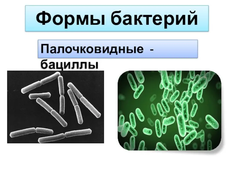 Формы бактерий Палочковидные - бациллы