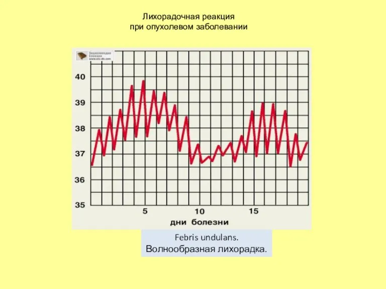 Лихорадочная реакция при опухолевом заболевании Febris undulans. Волнообразная лихорадка.