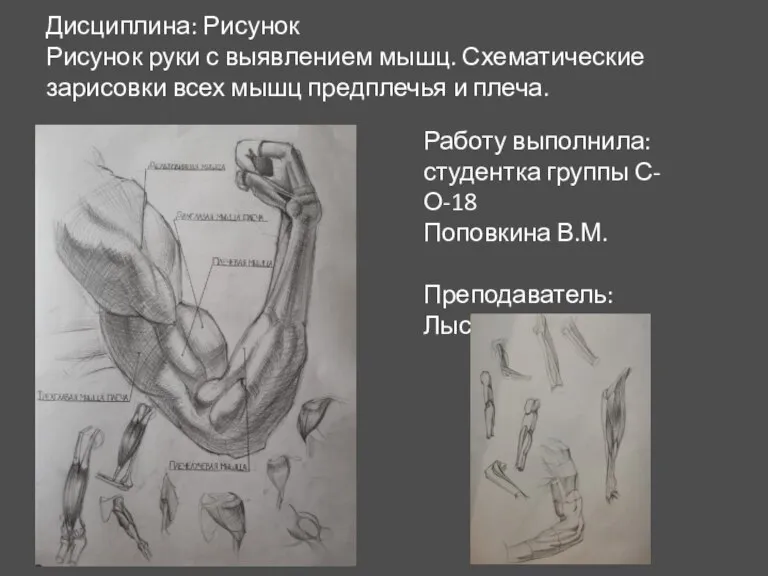 Дисциплина: Рисунок Рисунок руки с выявлением мышц. Схематические зарисовки всех мышц предплечья