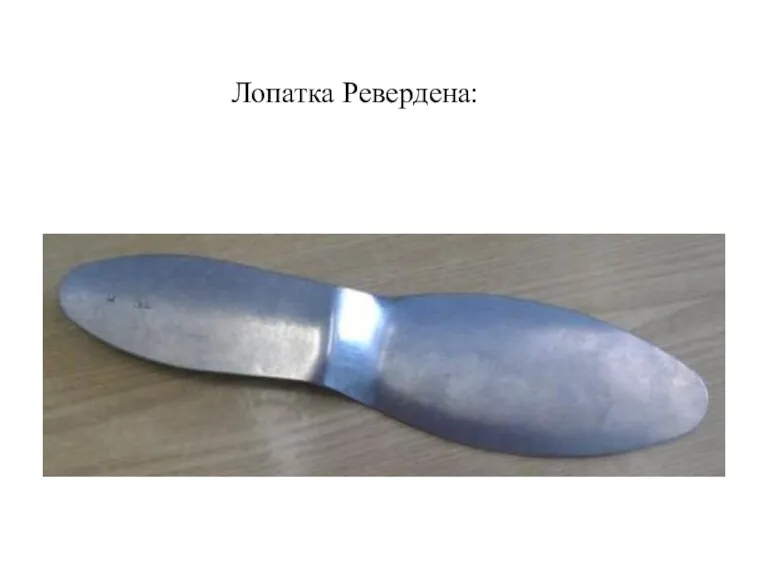 Лопатка Ревердена: